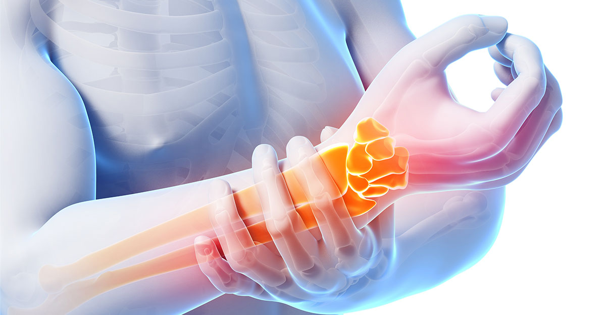 Tumwater natural carpal tunnel treatment